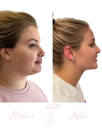Website Before & After