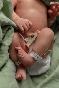 Tiny Feet and the Umbilical Cord Clamp.