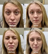 Letybo+before+and+after