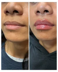 Injectables Page 10