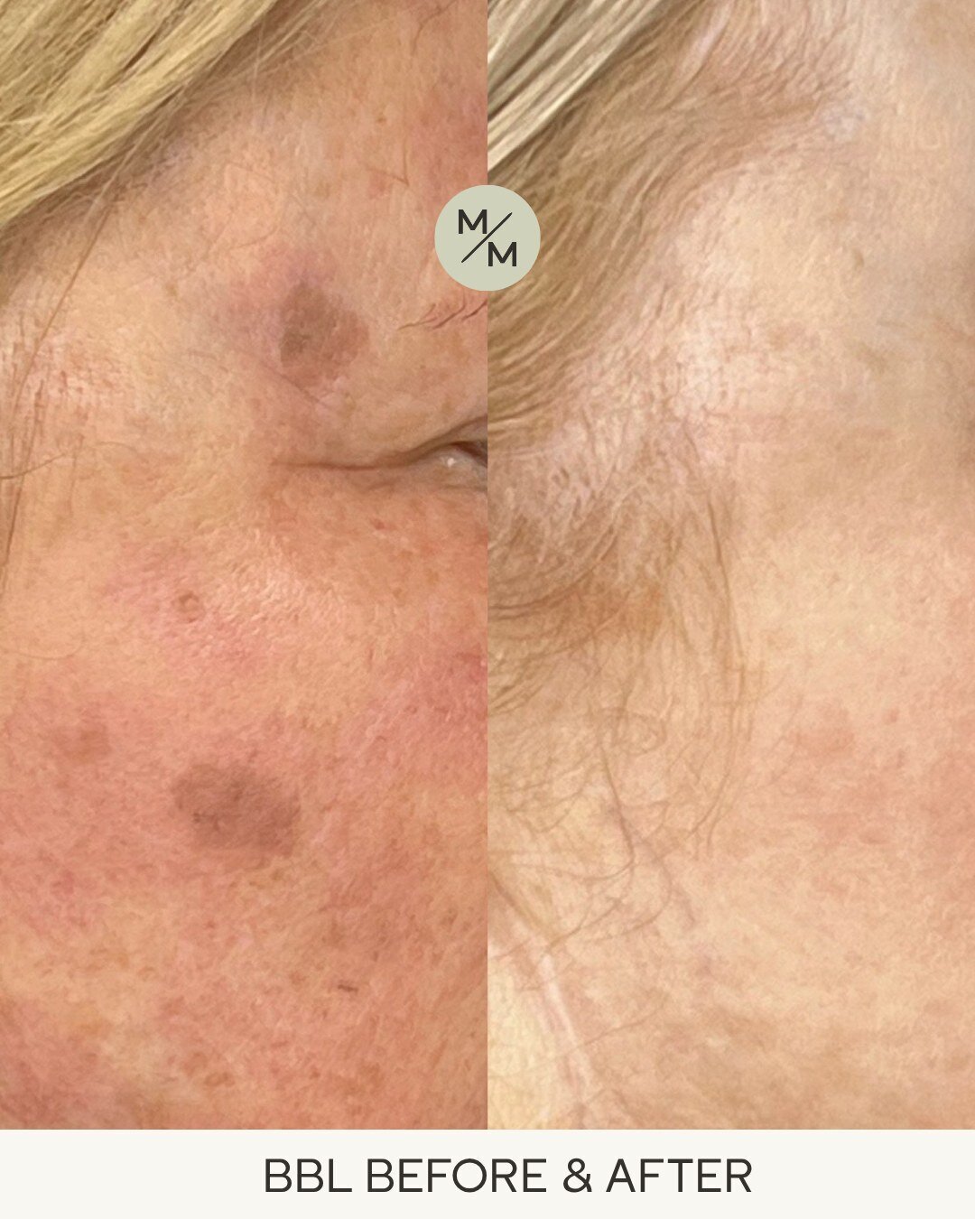 Medspa Services in New Hampshire | Modern Medspa