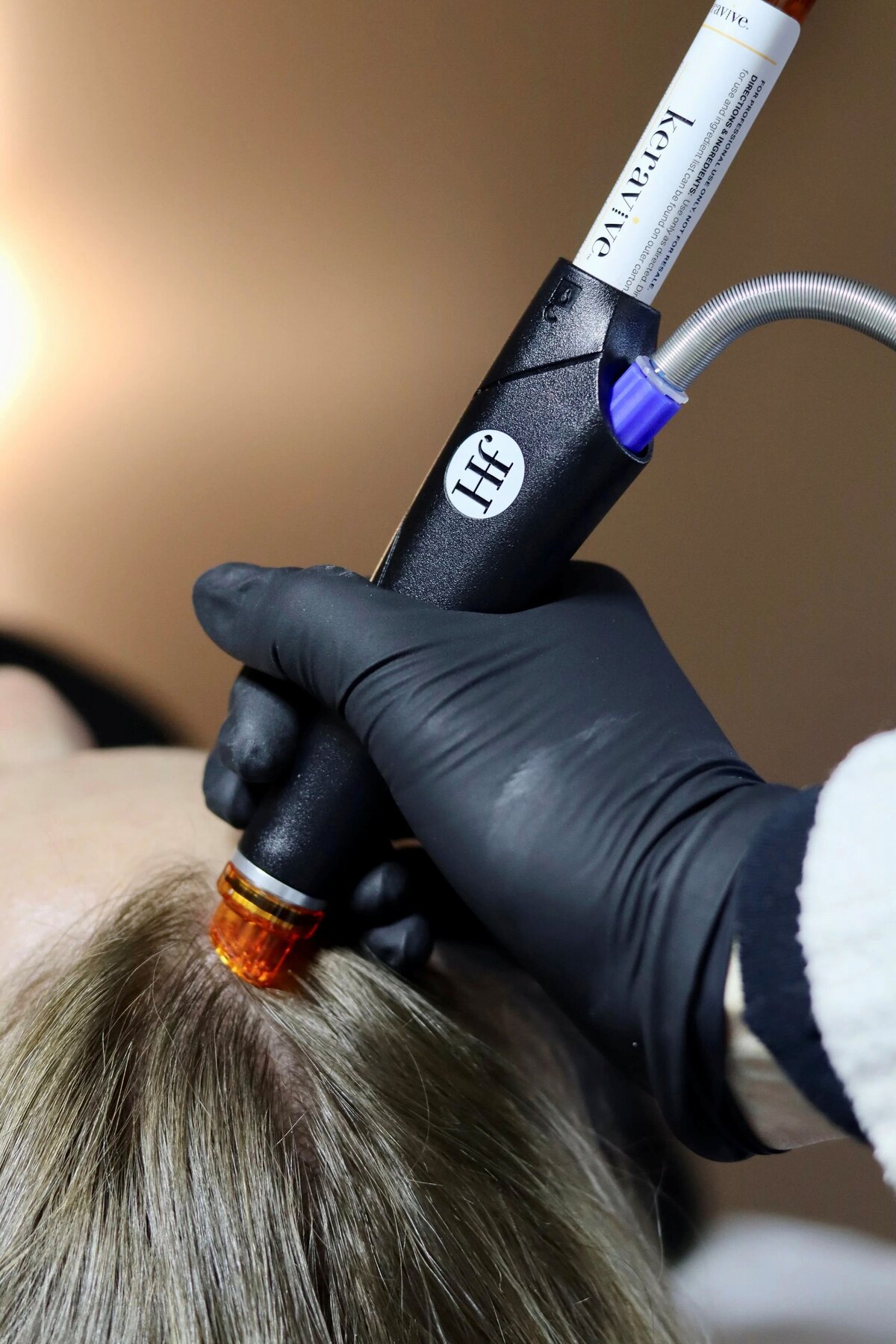 Keravive Scalp Treatment in Hooksett, NH | Modern Medspa
