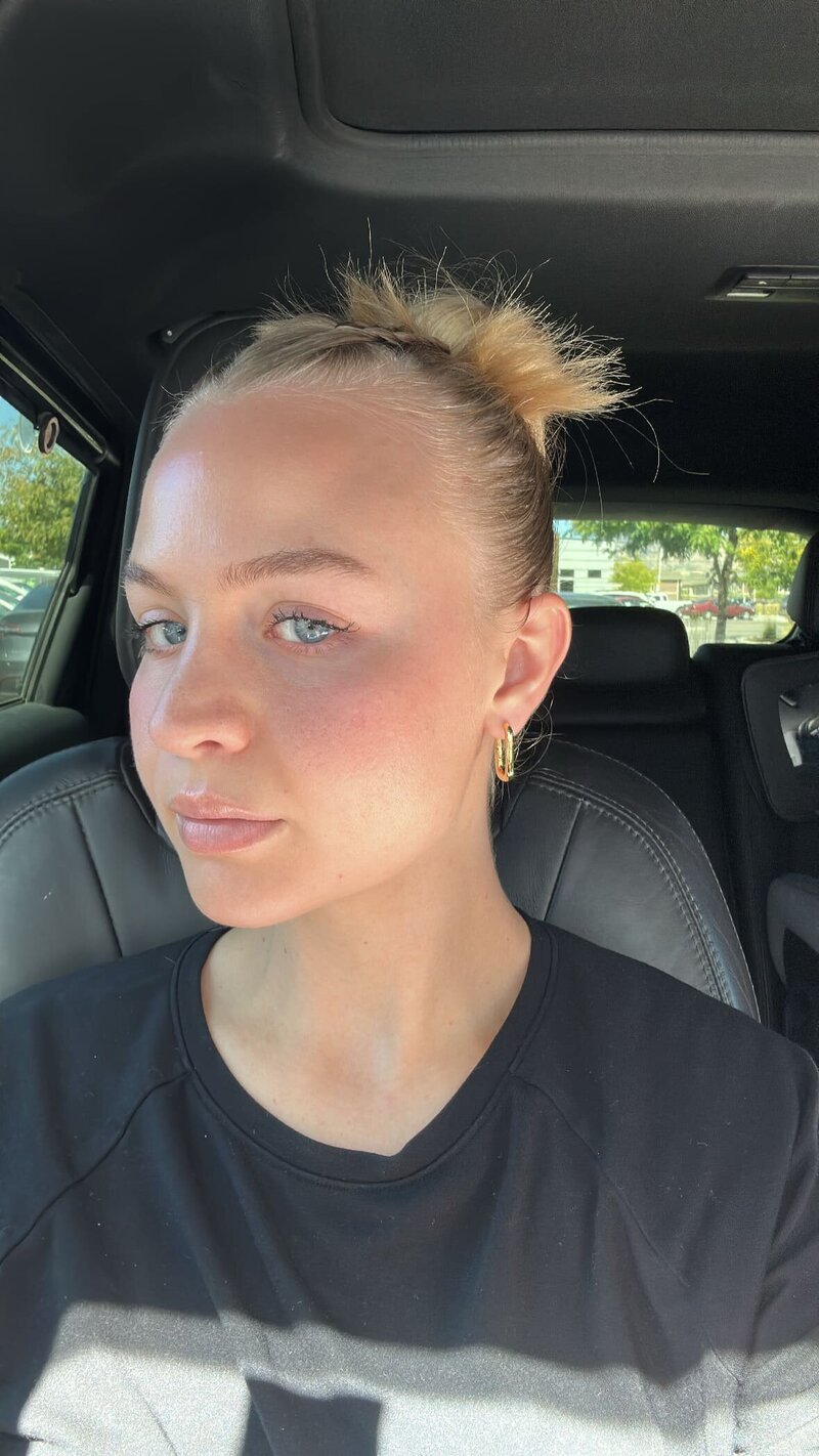 Lissy Skincare result 1
