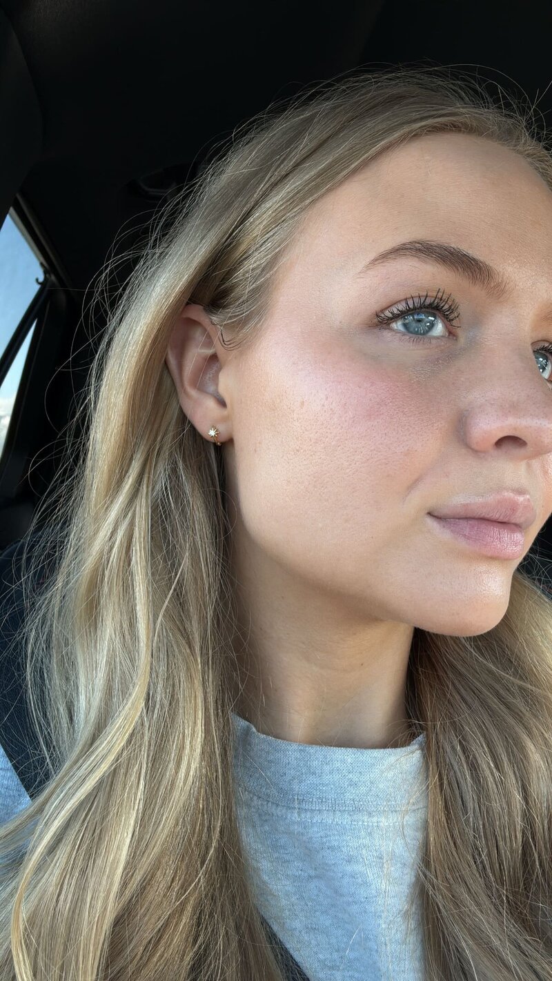 Lissy Skincare result 2