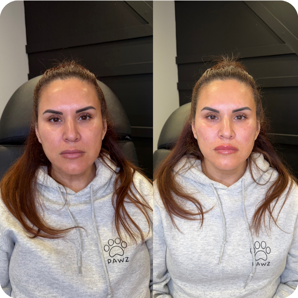 before-after-2