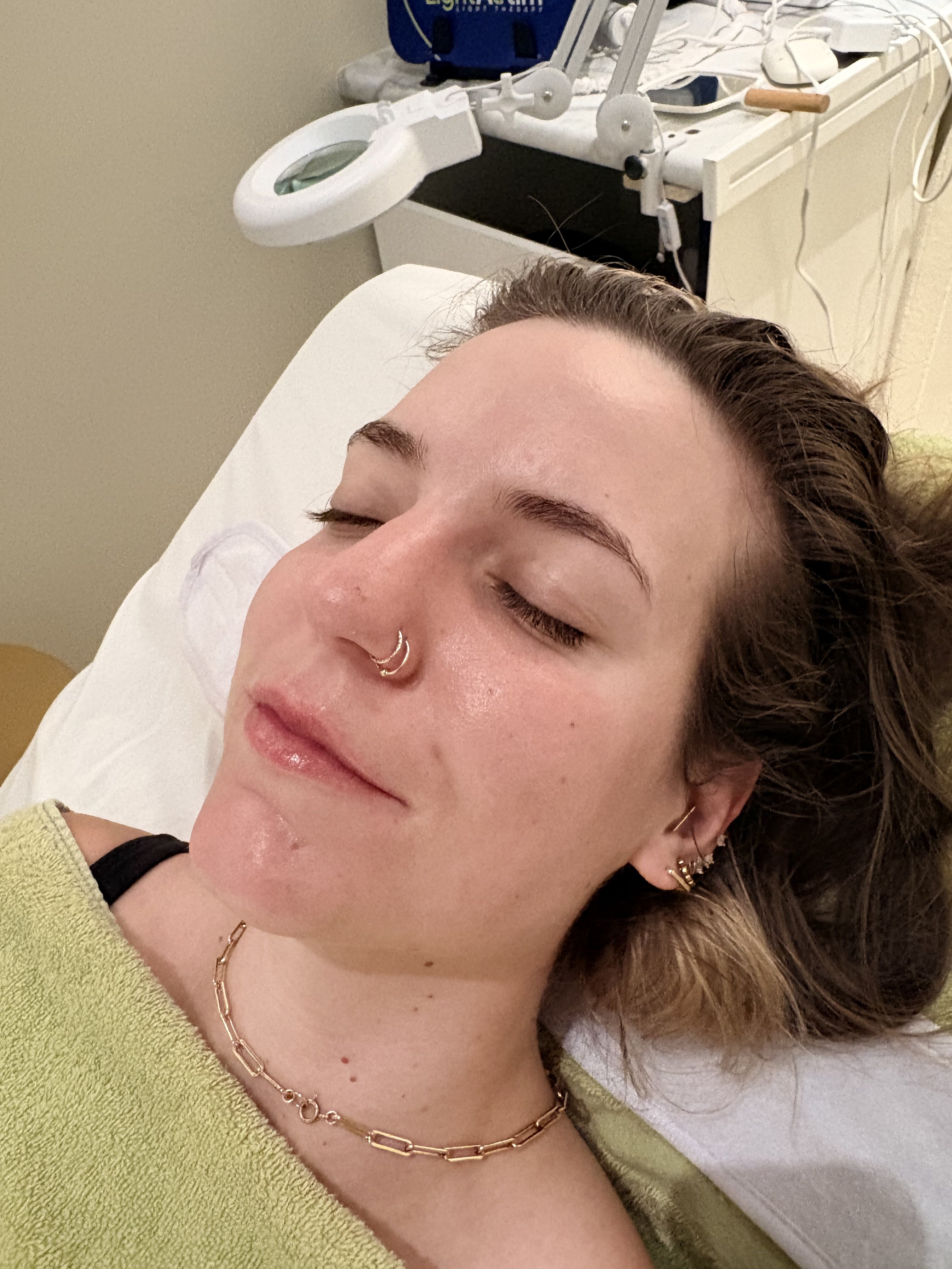 Glowing skin after a Skinversity facial