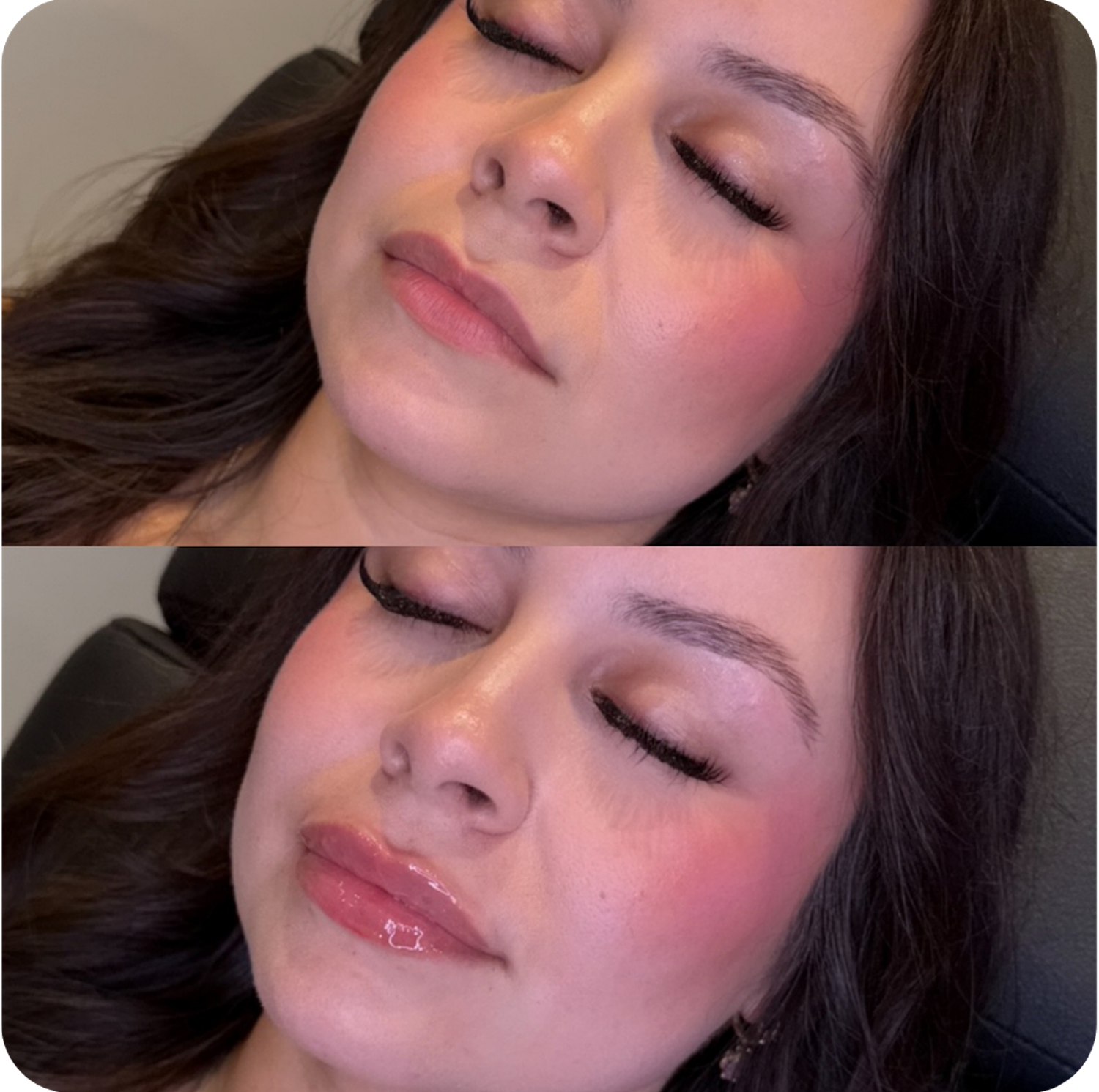 before-after