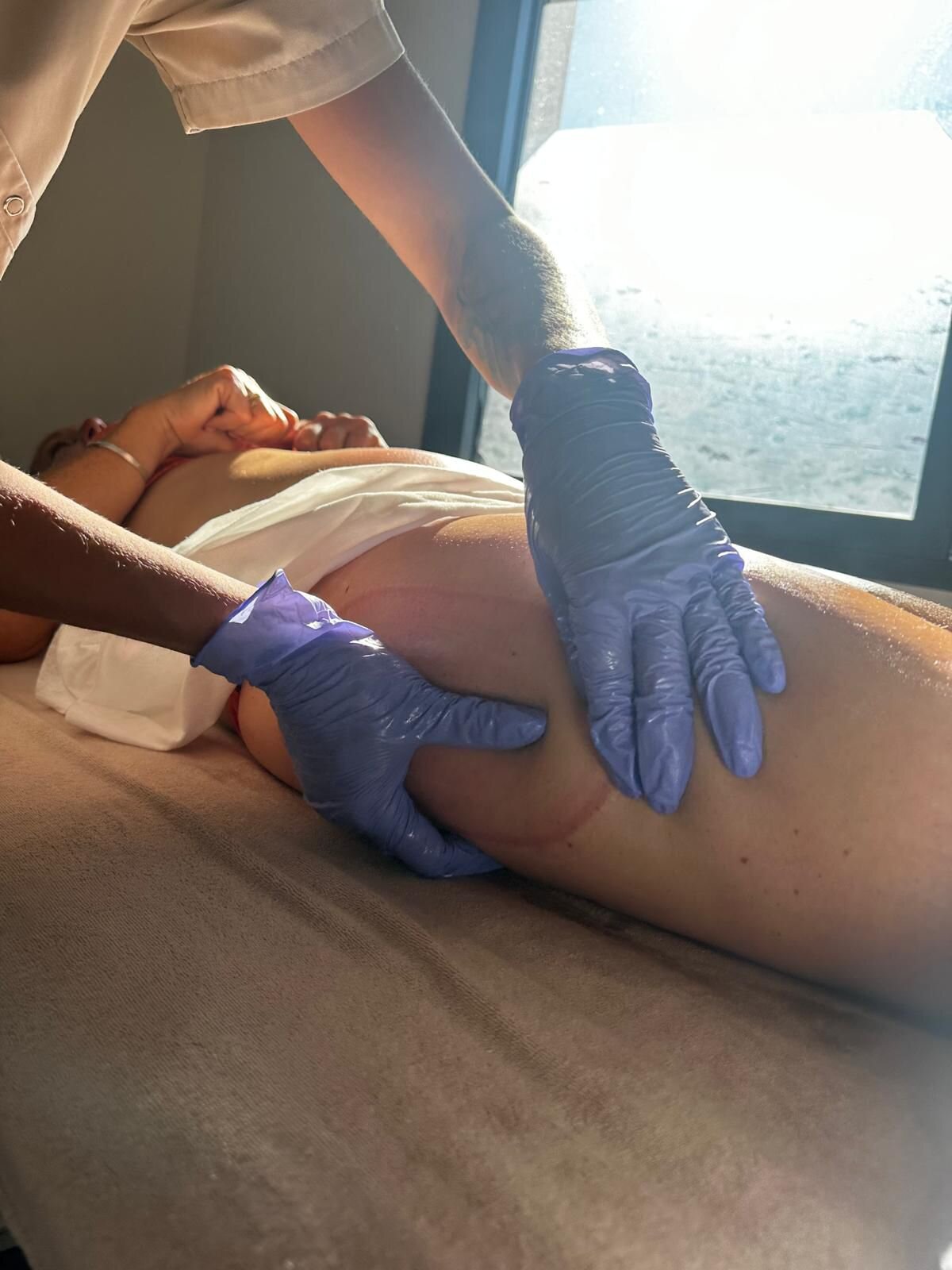 Cryolipolyse par plaques Centre Novaria