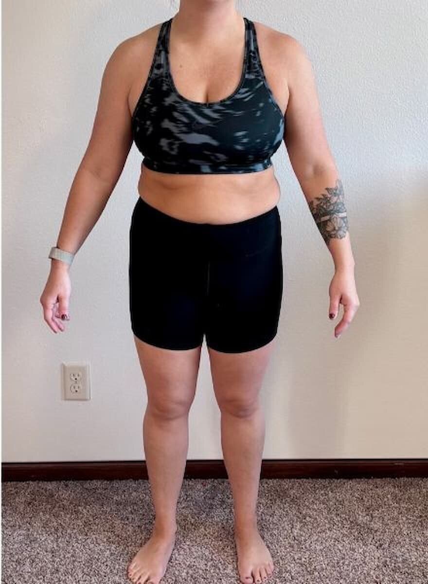 Jennifer B.’s before photo
