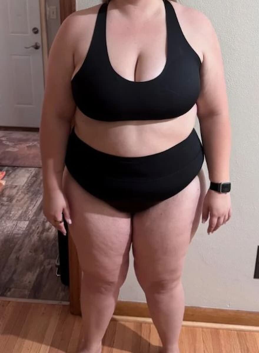 Natalie S.’s before photo