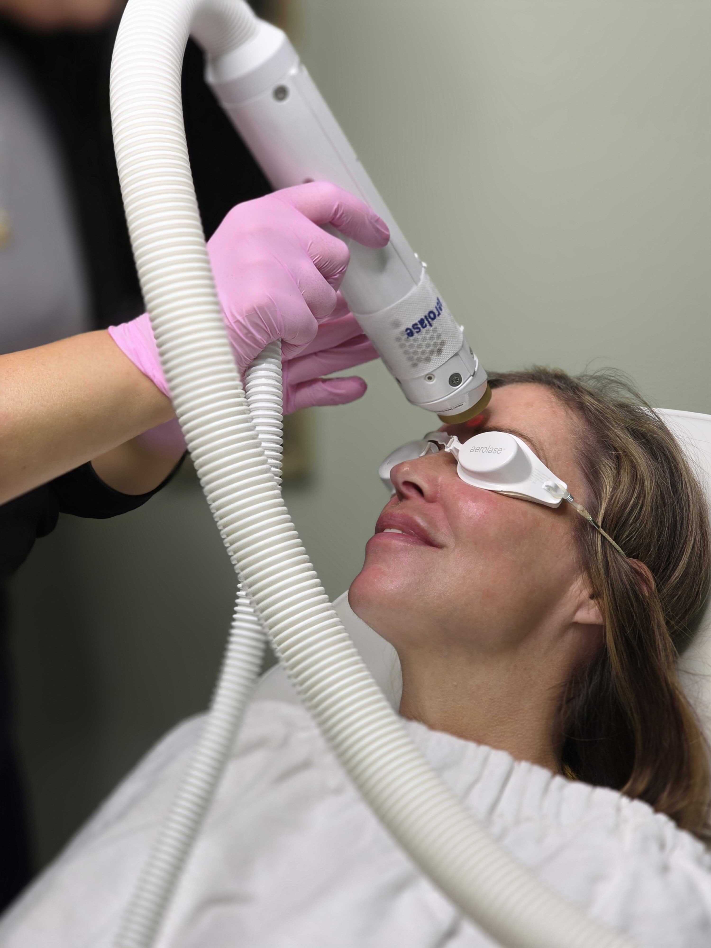 Aerolase laser skin rejuvenation treatment at Vogue Salon and Med Spa in Delaware