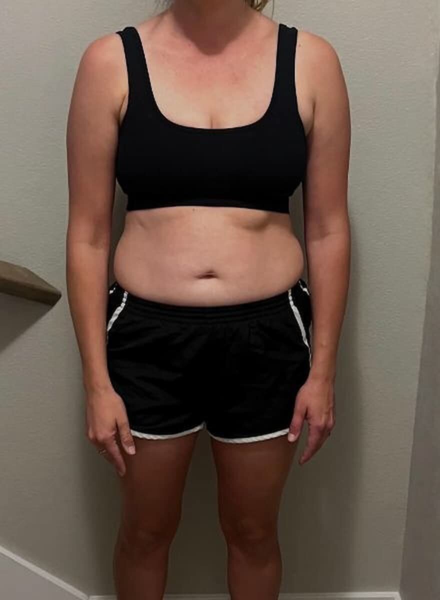 Megan’s before photo, front view